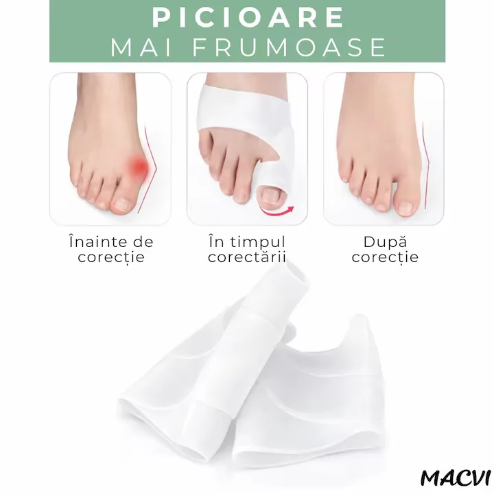 Corector monturi MACVI, set 1 pereche, silicon medical, alb, 7x9cm - imagine 3