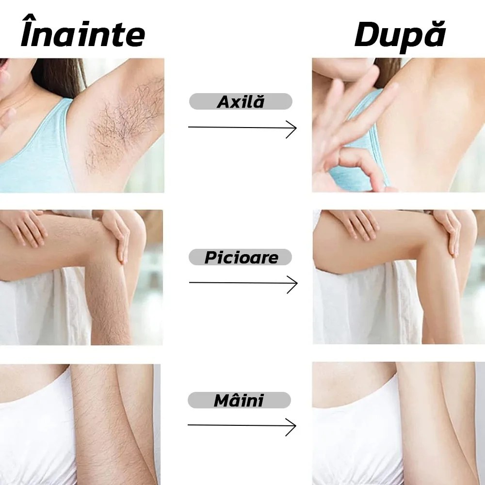 Epilator Macvi® cu Cristale, Fara Durere, Portabil, Unisex, IP67, Auriu - imagine 2